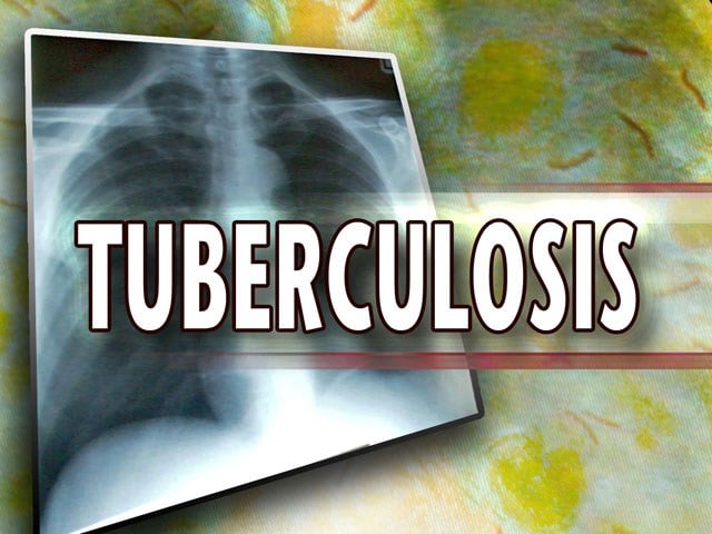 State: 27 at Olathe high school tested positive for tuberculosis ...